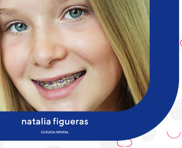 ¿Cuándo se puede empezar con la ortodoncia en niños?