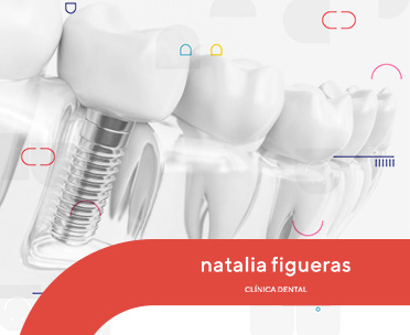 implante dental-Barcelona